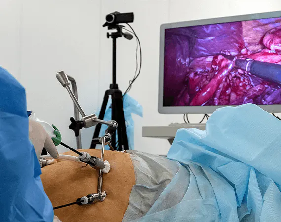 Laparoscopic surgery is a approach to medical procedures that prioritizes patient comfort and speedy recovery.